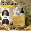 Aceite natural para el crecimiento del cabello Lovocross