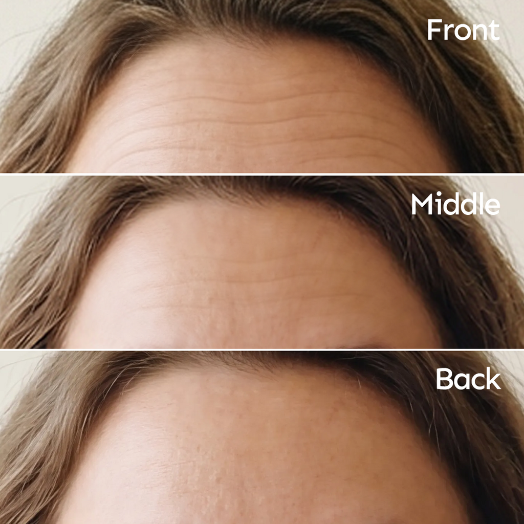 Parches Faciales Antiarrugas para una Piel más Suave