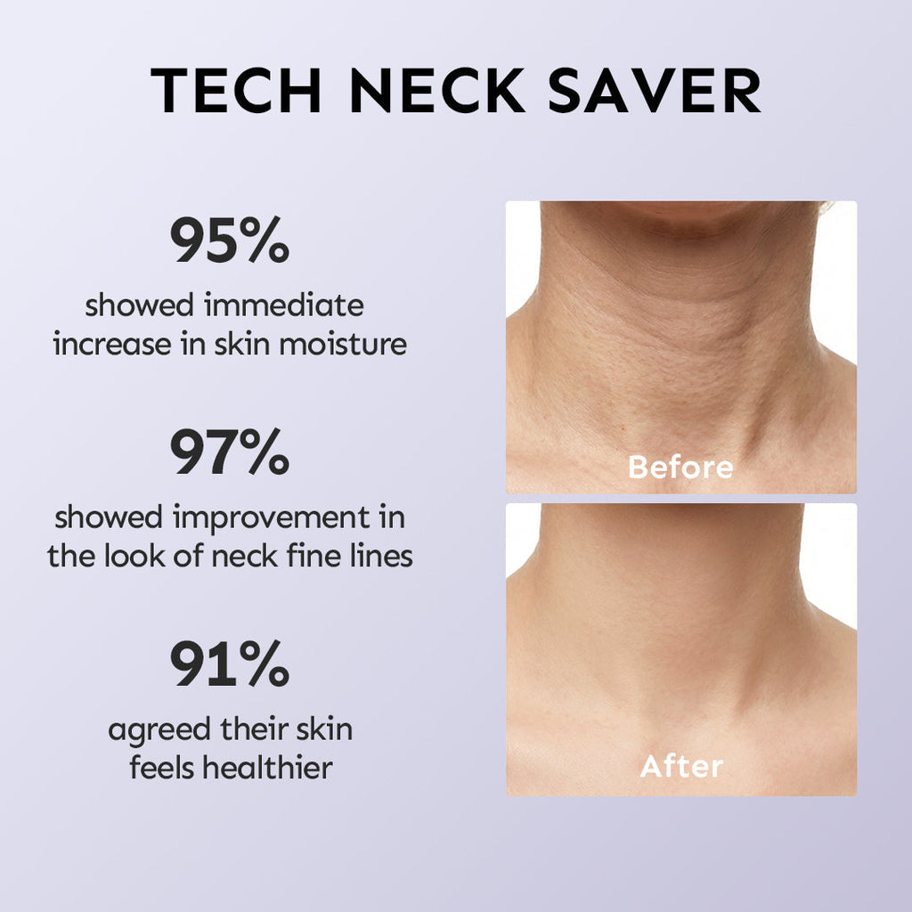 Crema para el Rescate del Cuello de Lovocross – Suaviza las líneas del cuello, Reafirma e Hidrata Profundamente