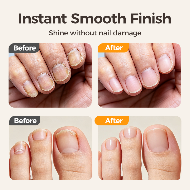 2-in-1 Electric Nail Clipper & Smoother